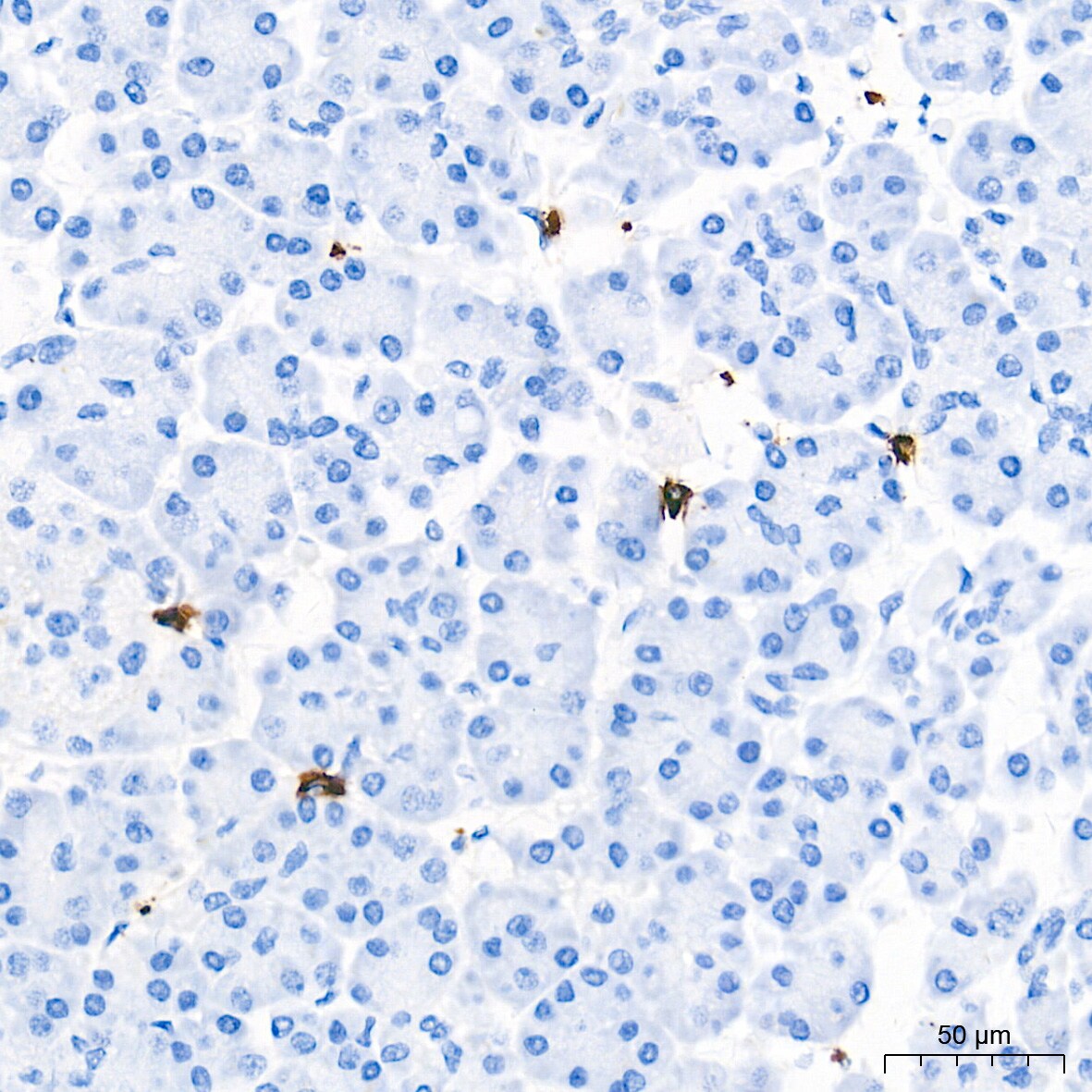 Tryptase beta-2/TPSB2 Antibody (6U1C5)