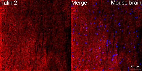 Talin2 Antibody (7D1Y0)