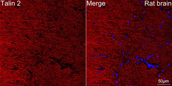 Talin2 Antibody (7D1Y0)