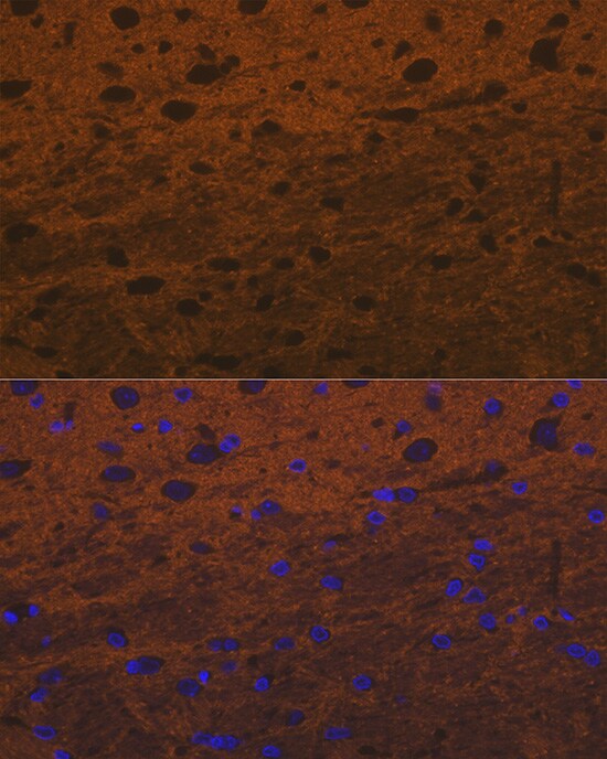 Syntaxin Antibody (7D9V8)
