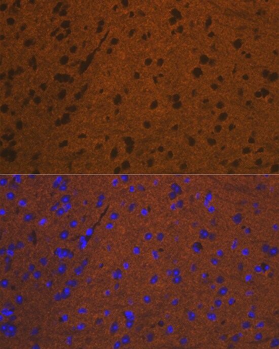 Syntaxin Antibody (7D9V8)