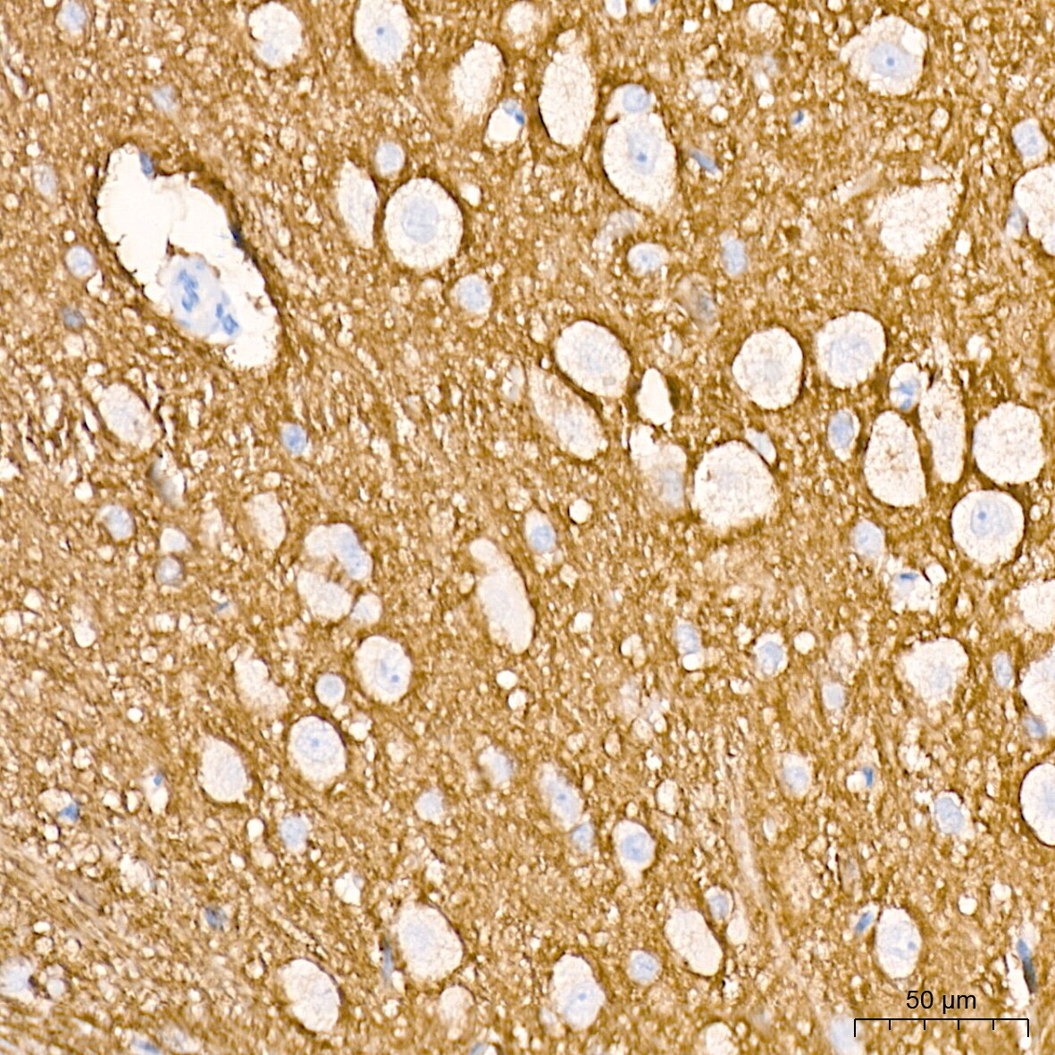 Syntaxin Antibody (7D9V8)