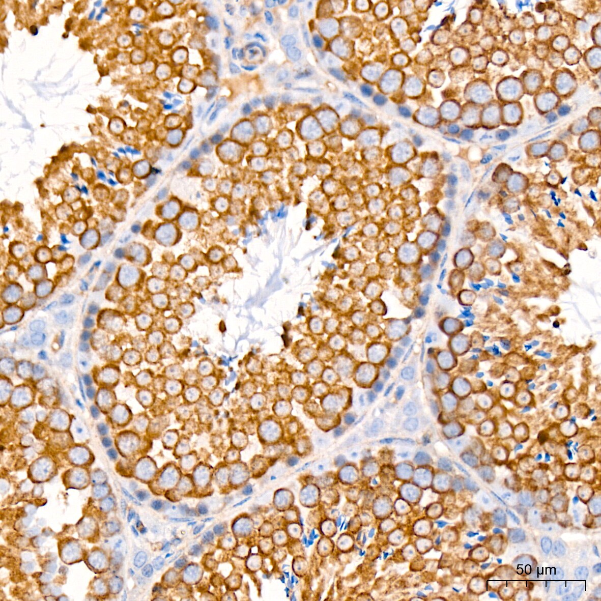 Syntaxin Antibody (7D9V8)
