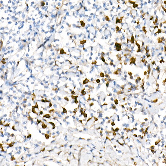Lambda Light Chain Antibody (1R9H8)