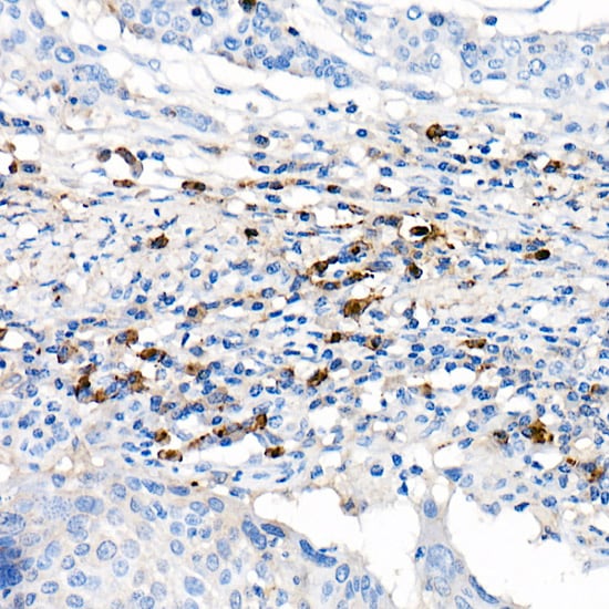Lambda Light Chain Antibody (1R9H8)