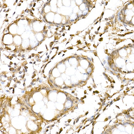 RNF126 Antibody - Azide and BSA Free