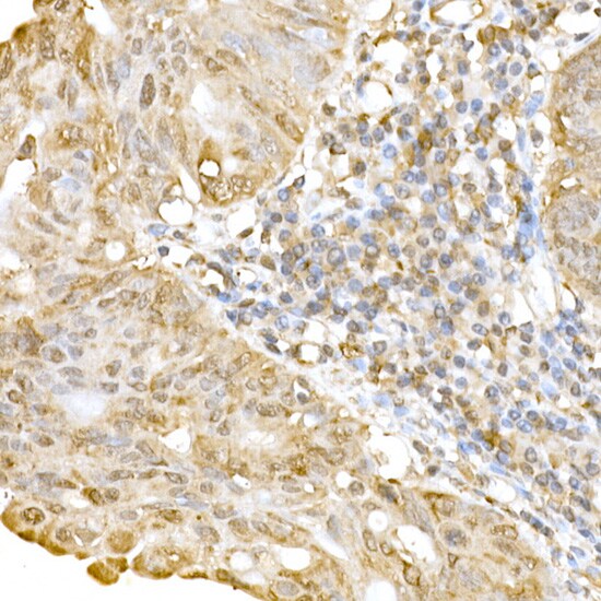 RNF126 Antibody - Azide and BSA Free
