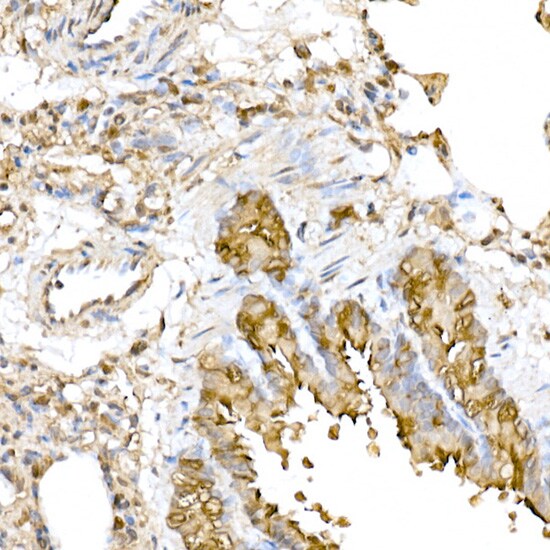 RNF126 Antibody - Azide and BSA Free