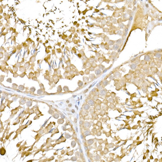 RNF126 Antibody - Azide and BSA Free