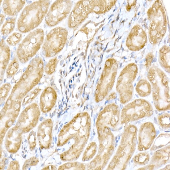RNF126 Antibody - Azide and BSA Free
