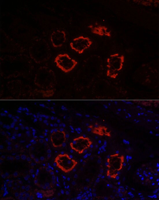 SGLT2/SLC5A2 Antibody - Azide and BSA Free