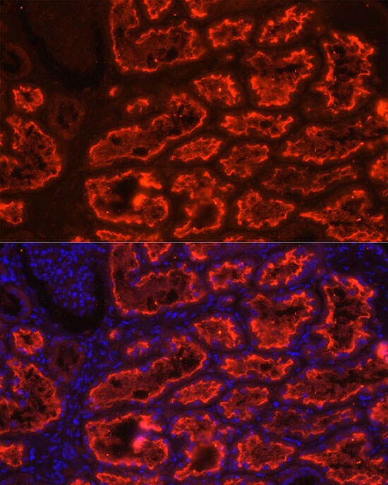 SGLT2/SLC5A2 Antibody - Azide and BSA Free
