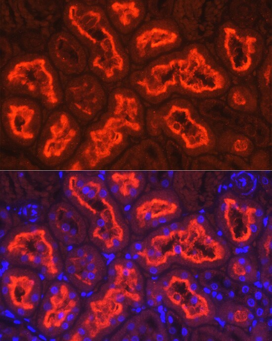 SGLT2/SLC5A2 Antibody - Azide and BSA Free