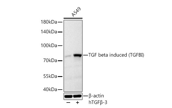Beta Ig-h3/TGFBI Antibody (7Q5O9)