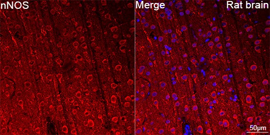nNOS Antibody (5K9R2)