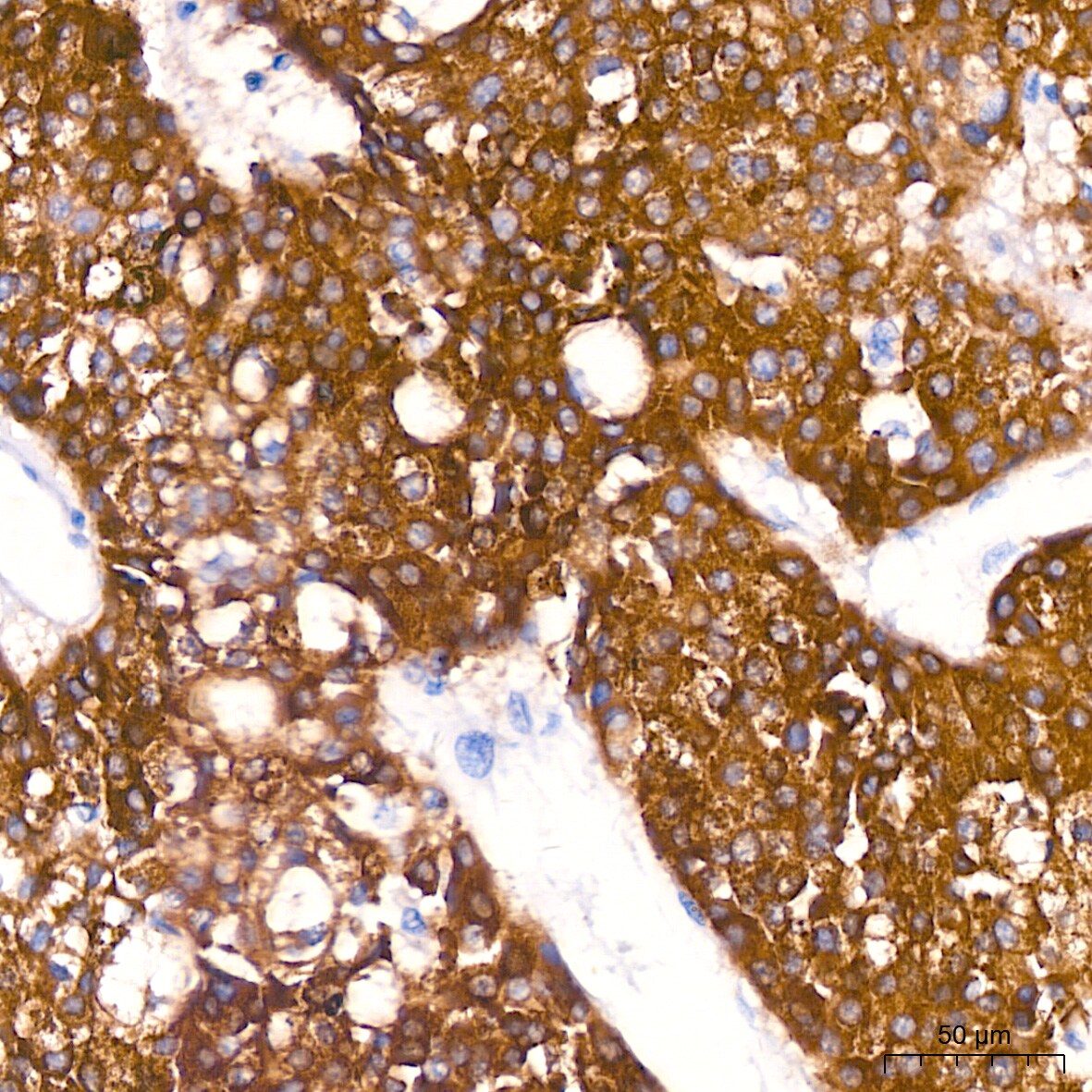 FACL4 Antibody (4W3T9)