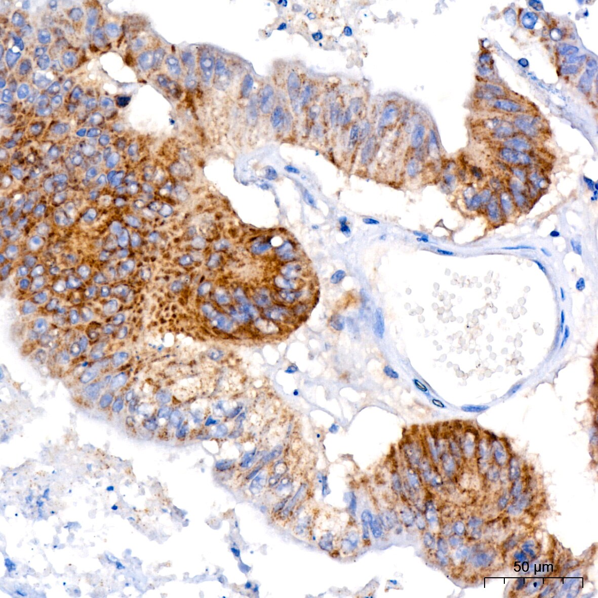 FACL4 Antibody (4W3T9)