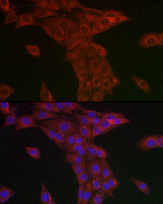 Syntrophin alpha 1 Antibody - Azide and BSA Free