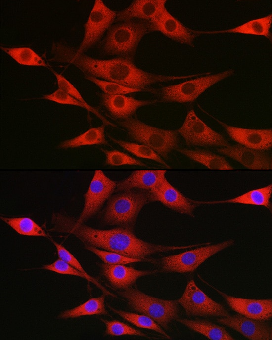 SSR2 Antibody - Azide and BSA Free