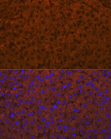 ADAMTS13 Antibody (7B2Z8)