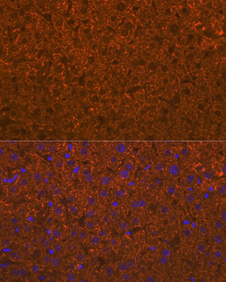 ADAMTS13 Antibody (7B2Z8)