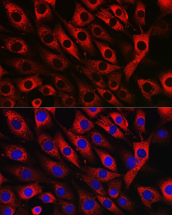 UFL1 Antibody - Azide and BSA Free