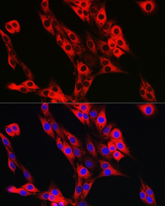 UFL1 Antibody - Azide and BSA Free