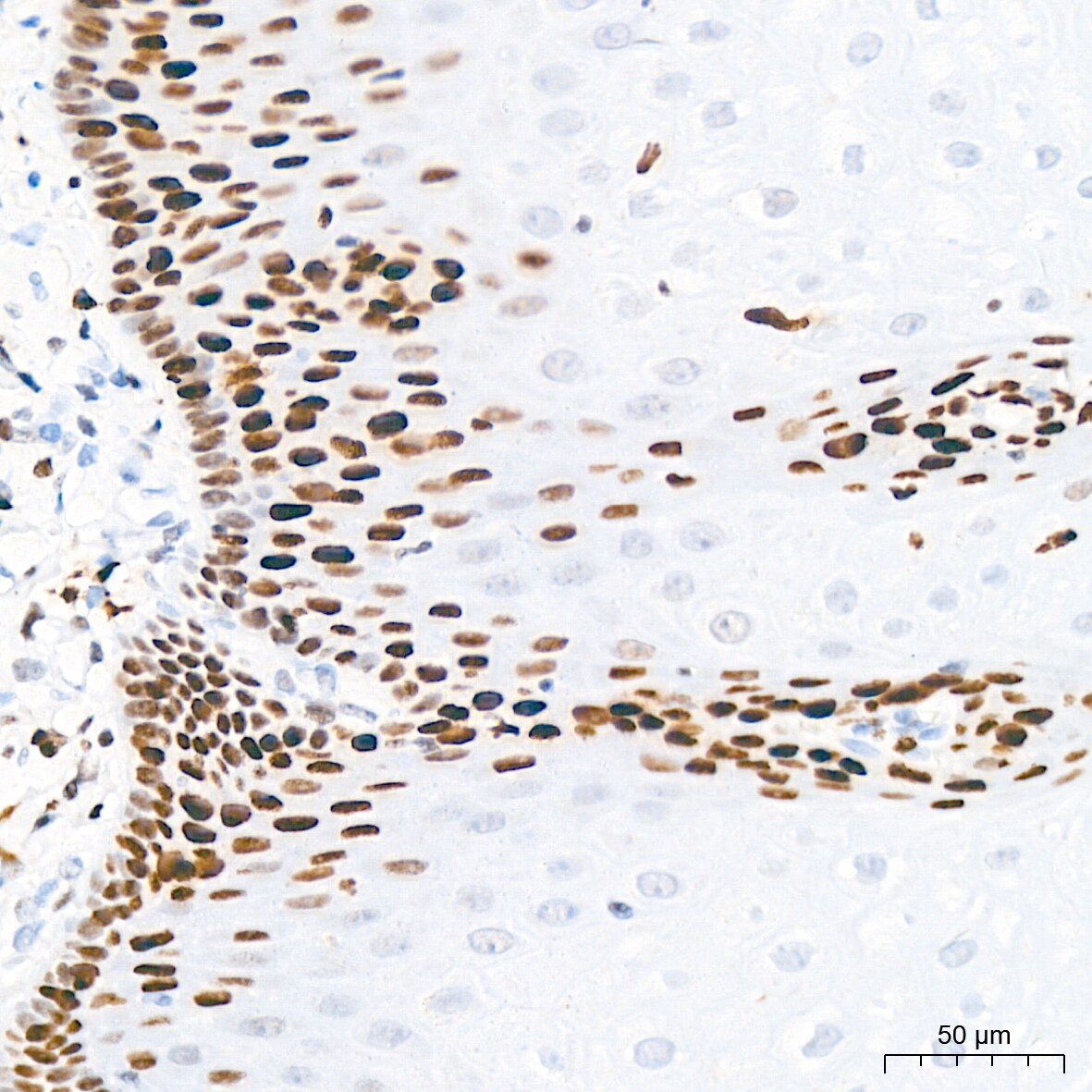 MCM2 Antibody (0Q10S9)