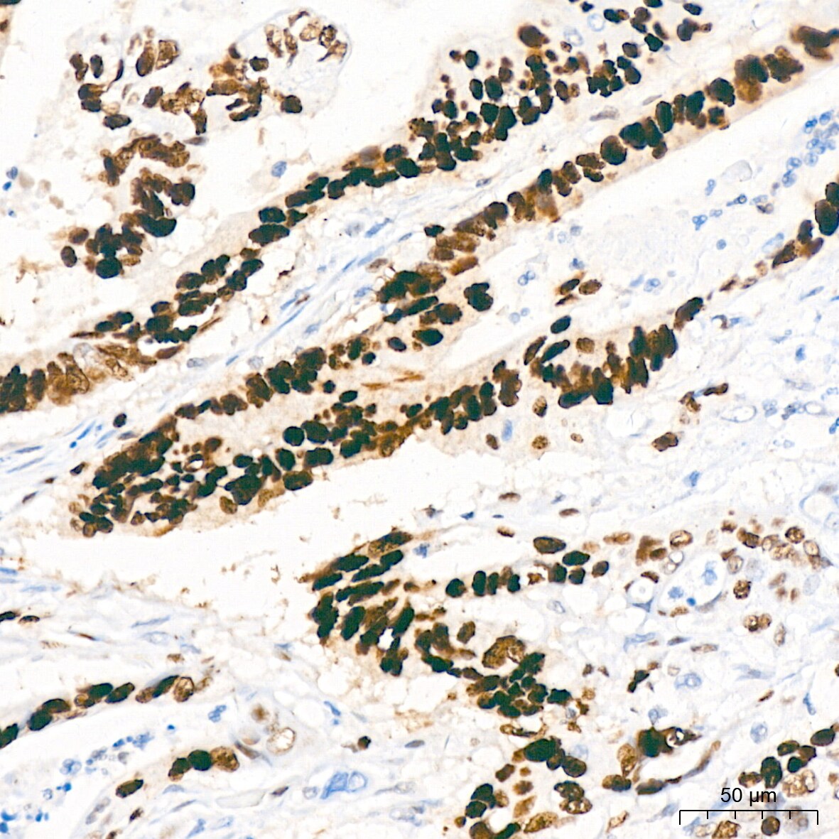 MCM2 Antibody (0Q10S9)