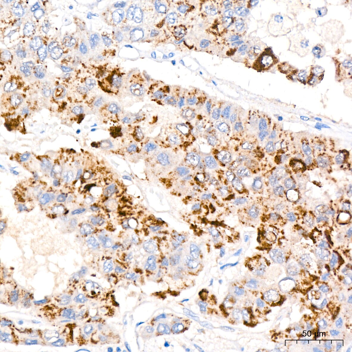 MMP-7 Antibody (8T4R8)
