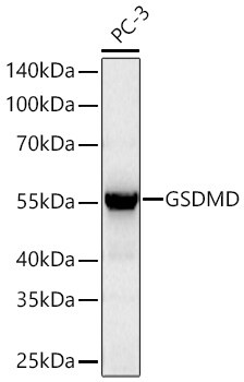 GSDMDC1 Antibody (5U7R7)