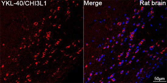Chitinase 3-like 1/YKL-40 Antibody (7T1R3)