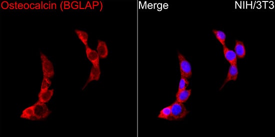 Osteocalcin Antibody (2T1J7)