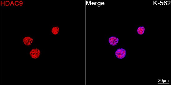 HDAC9 Antibody (3L5E5)