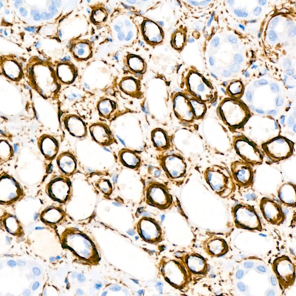 Actin Antibody (3U6B8)