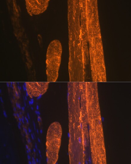 Actin Antibody (3U6B8)