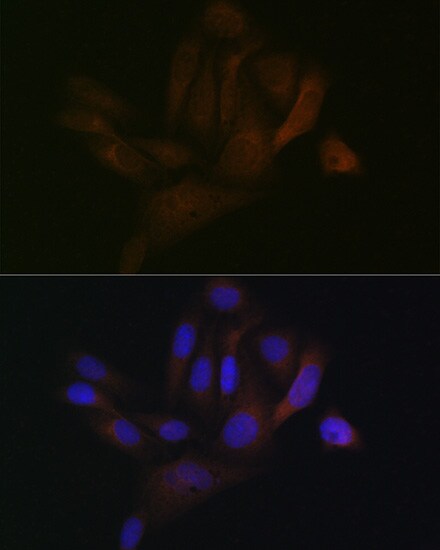 BCAP31 Antibody (7R10K2)