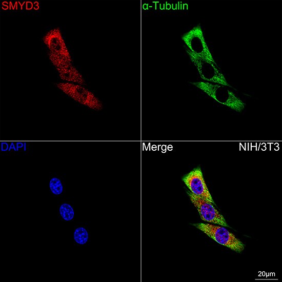 SMYD3 Antibody (2P8Z2)