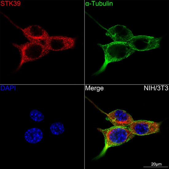 STK39 Antibody (0D9L5)