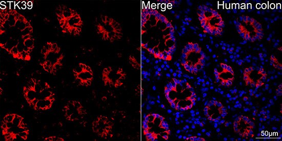 STK39 Antibody (0D9L5)
