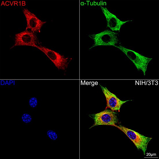 Activin RIB/ALK-4 Antibody (3U6I8)