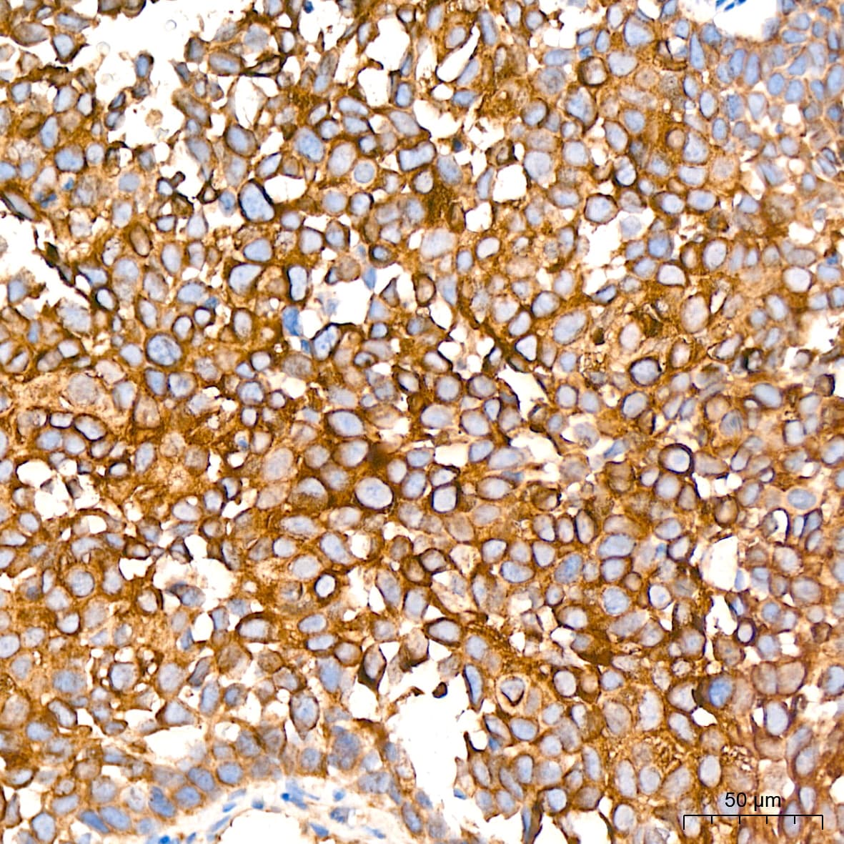 Activin RIB/ALK-4 Antibody (3U6I8)