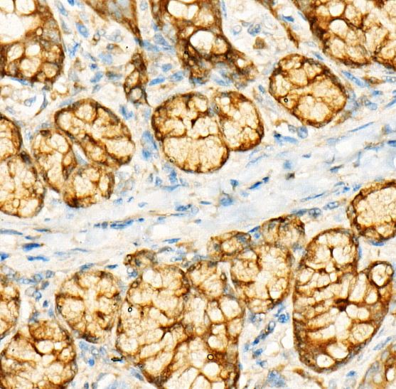GCN2 Antibody (6E2X0)