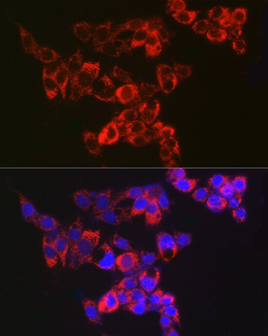AK3L1 Antibody (9T5P1)