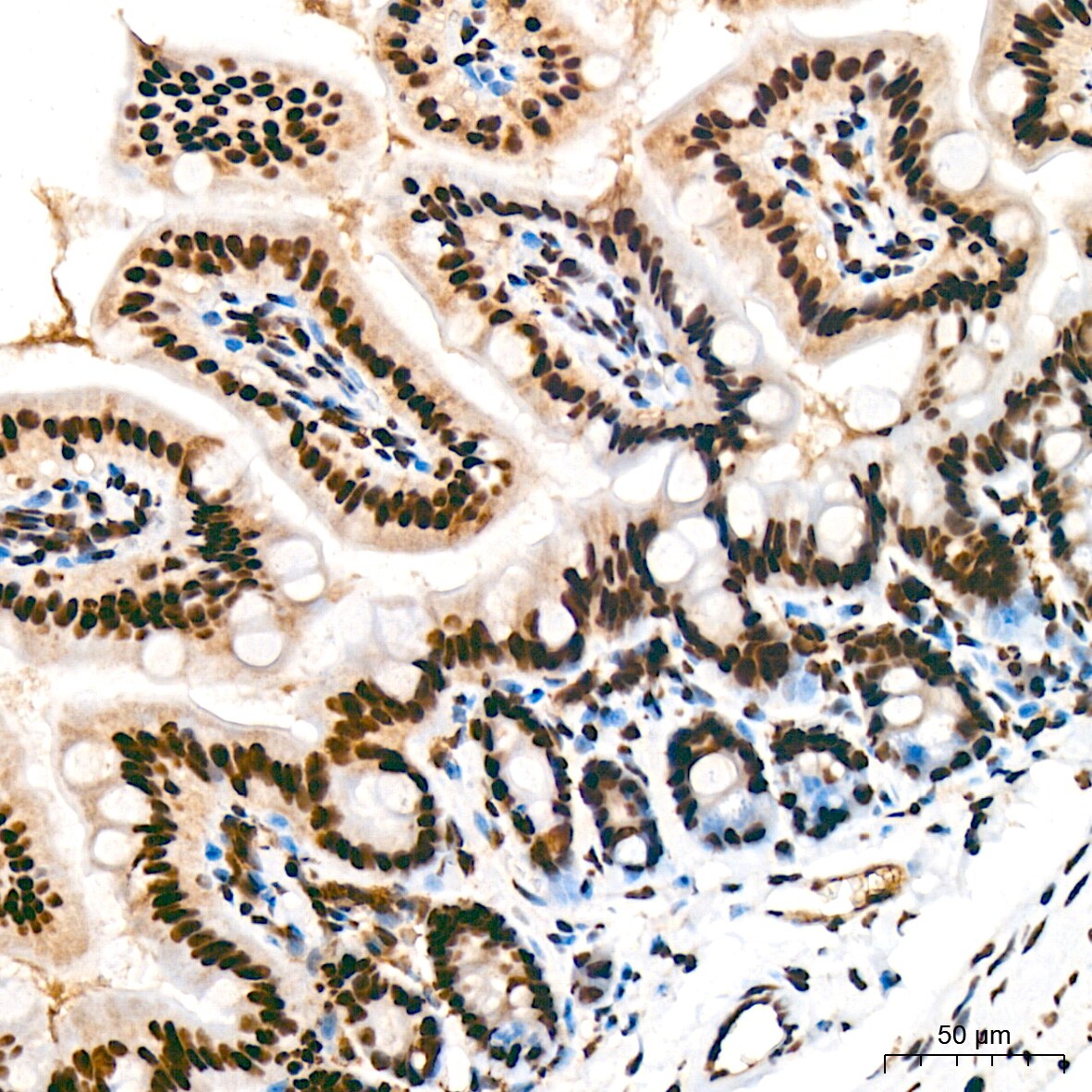 USP39 Antibody (1S9R9)