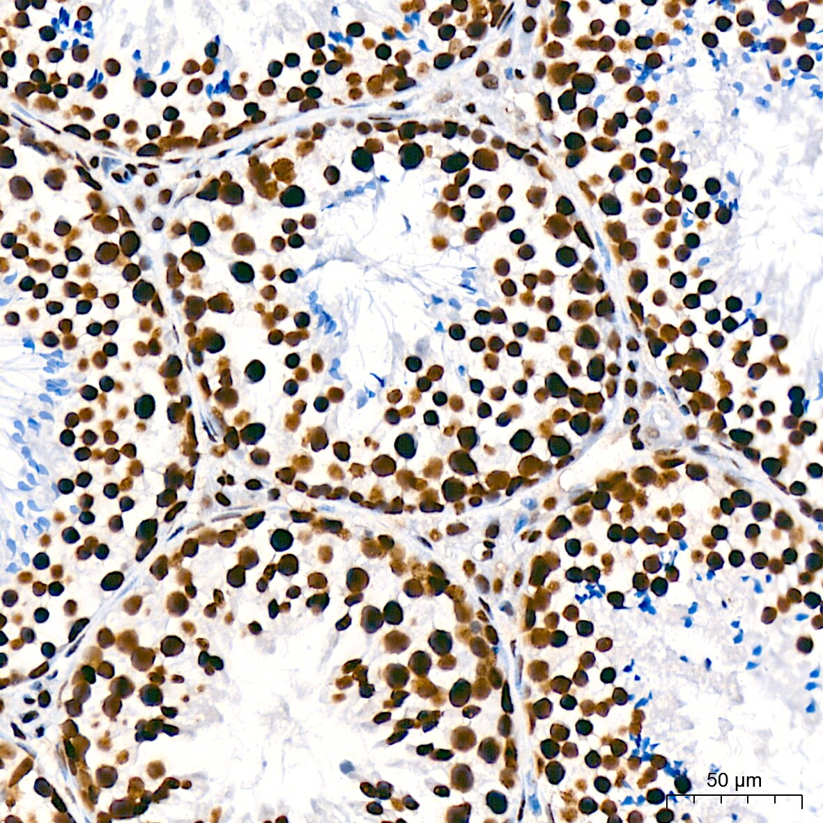 USP39 Antibody (1S9R9)