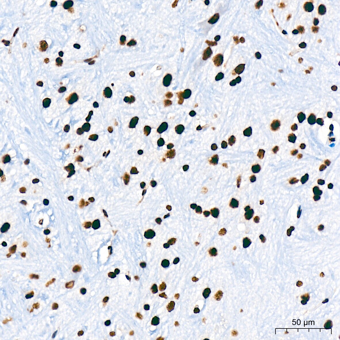 USP39 Antibody (1S9R9)