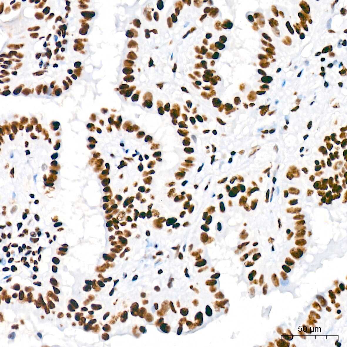 USP39 Antibody (1S9R9)