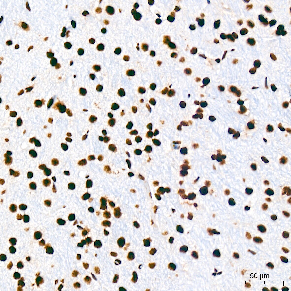 USP39 Antibody (1S9R9)