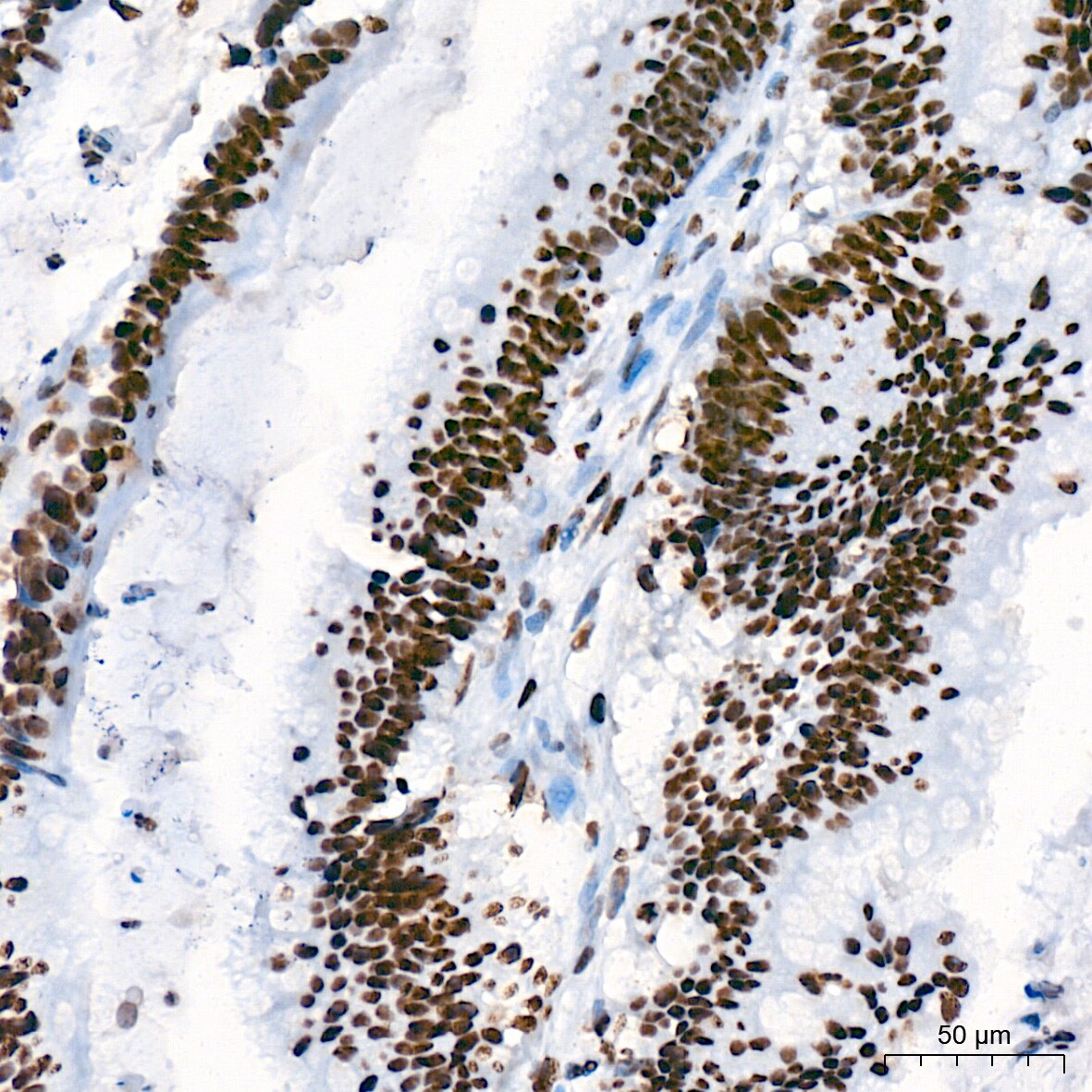USP39 Antibody (1S9R9)